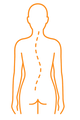Scoliose